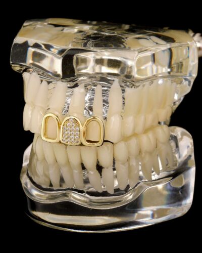 Openwork Gold-Plated Three Tooth Grillzs